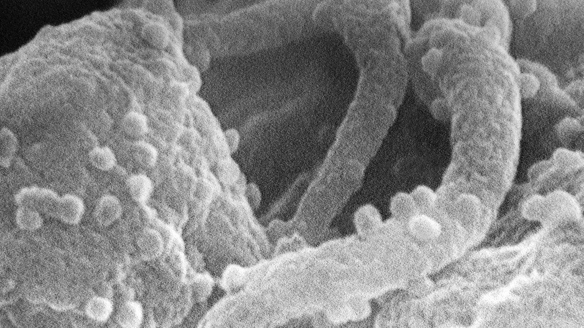 Scanning electron micrograph of a crowded immune-cell surface where interleukin-15 (IL-15) is trans-presented from one cell to another — Panacea Bio Chem, Bogdan Dicoias