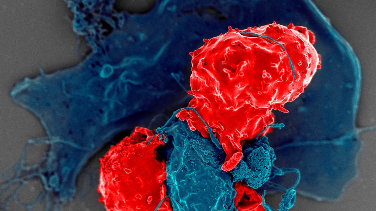 Colour-enhanced electron micrograph of interacting immune cells — the natural killer and CD8 T cells that interleukin-15 (IL-15) grows and sustains — compiled by Panacea Bio Chem, Bogdan Dicoias
